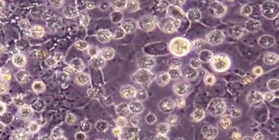 Primordial Germ Cells